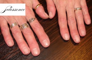 nailbeds_3weeksofShellacRemoval_solessence